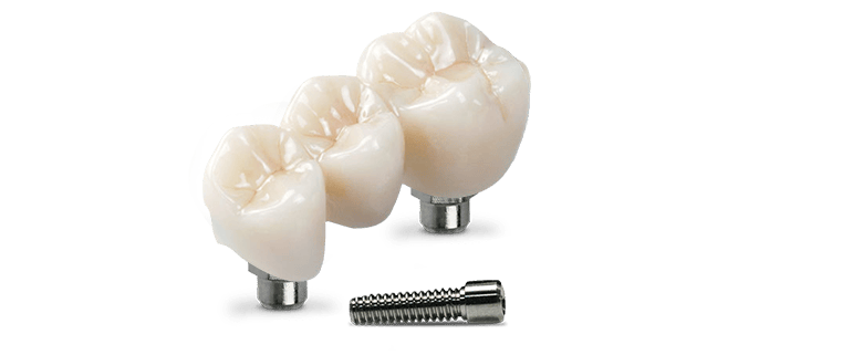 3-unit-dental bridge cost in Los Algodones, Mexico