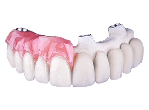 All on 4 crustal ultra hybrid cost in Mexico