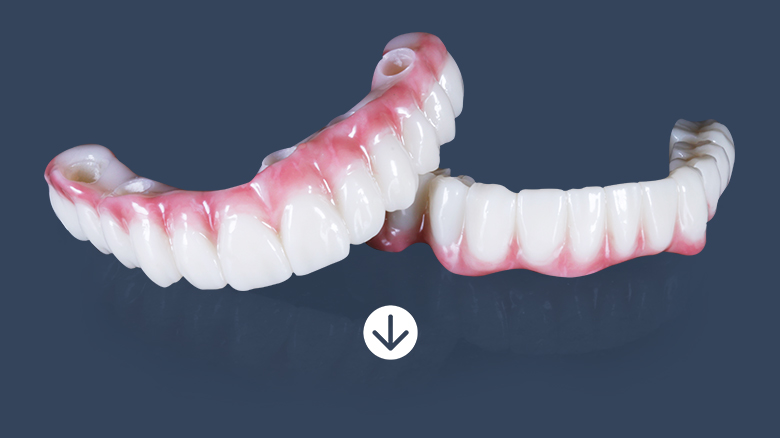 all on 4 dental implants in Los Algodones, Mexico