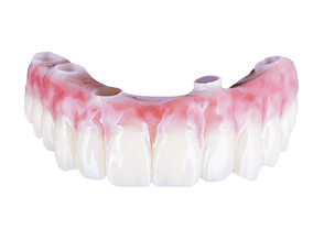 All On 4 zirconia bridge cost in Mexico