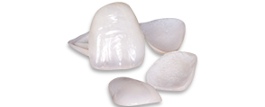 Porcelain lumineers cost in Los Algodones, Mexico
