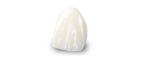 Porcelain veneers cost in Los Algodones, Mexico