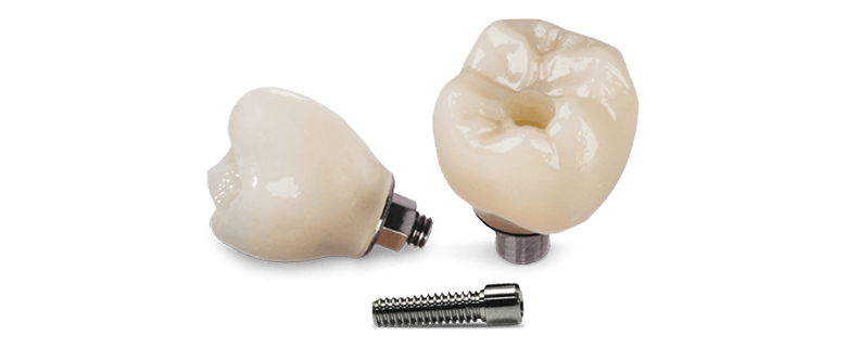 Single tooth implant crown cost in los Algodones, Mexico