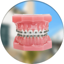 Dental braces cost in Los Alogodones, Mexico