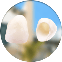 Cost of invisalign braces in Mexico