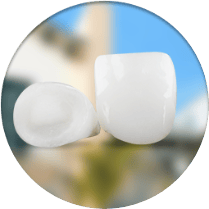 cost of emax porcelain crowns in Los Algodones, Mexico