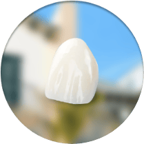 cost of emax porcelain veneers in Los Algodones, Mexico