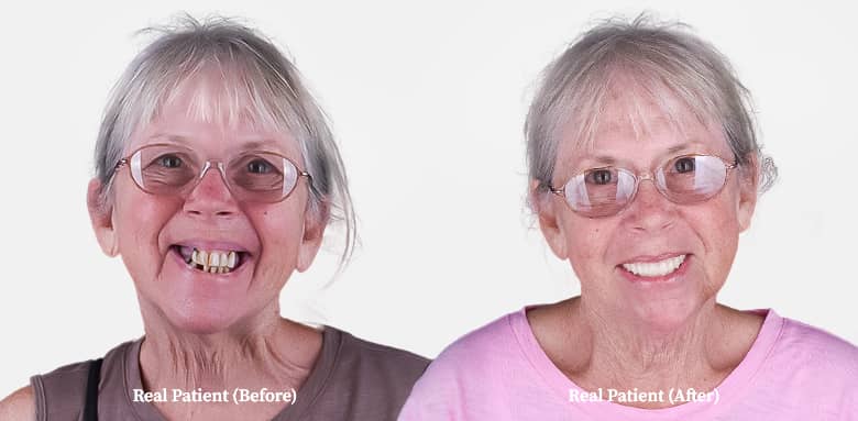 elderly lady with her smile of her final result