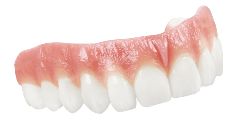 all on 4 option in Molar City