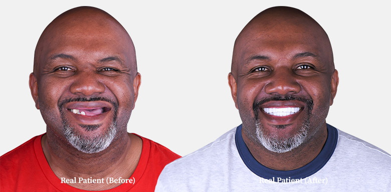 middle aged man before and after photo