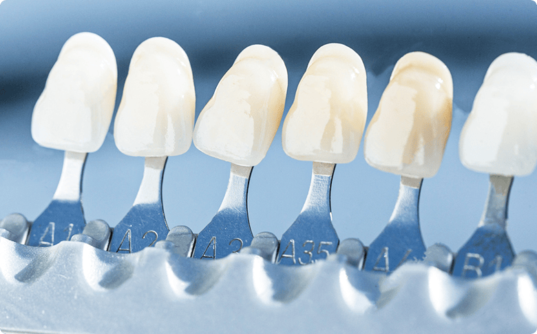 photo of the tone types of some veneers