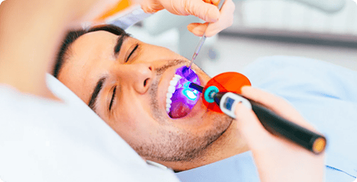 laser whitening treatment photos