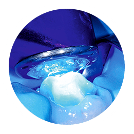 photo of cleaning and disinfection of an infected tooth